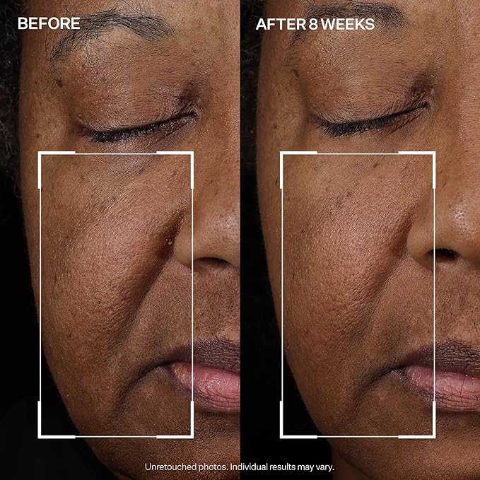 StriVectin Tighten and Lift Peptight Face Lift Serum with Tightening and Brightening Peptides for Wrinkles, Under Eye Bags and Puffiness, 30 mL