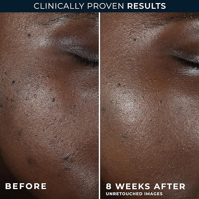 RoC Multi Correxion 5 in 1 Restoring/Anti Aging Facial Night Cream with Hexinol, 1.7 Ounces (Packaging May Vary)